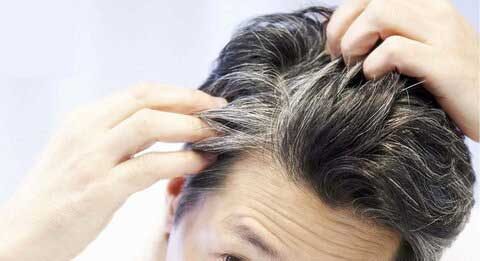 راهکارهای درمان سفیدی مو