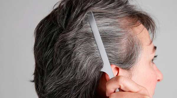 راهکارهای درمان سفیدی مو