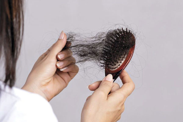 ریزش مو بر اثر تخمدان پلی کیستیک