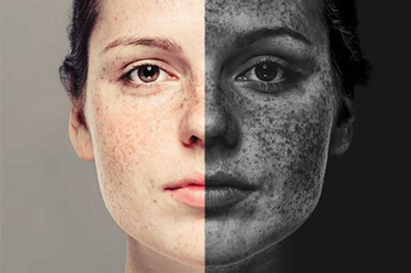 راه های جلوگیری از تاثیر الودگی روی پوست